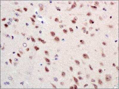 Immunohistochemistry: beta-1,3-Glucuronyltransferase 1/B3GAT1 Antibody - BSA Free [NBP1-78982]