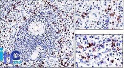 Immunohistochemistry-Paraffin: CD57 Antibody (NK-1) [NBP2-44352]