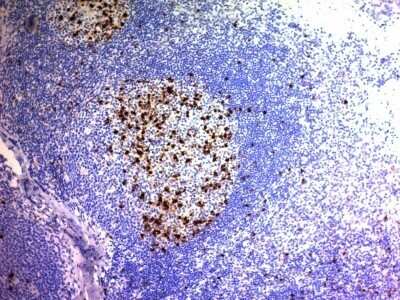 Immunohistochemistry-Paraffin: CD57 Antibody (NK/804) - Azide and BSA Free [NBP2-47792]