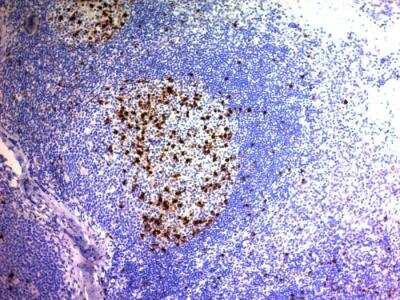 Immunohistochemistry-Paraffin: CD57 Antibody (NK/804) - IHC-Prediluted [NBP2-48366]