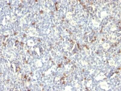 Immunohistochemistry-Paraffin: CD57 Antibody (SPM129) - Azide and BSA Free [NBP2-47790]