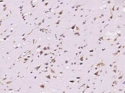 Immunohistochemistry-Paraffin: beta-1,3-Glucuronyltransferase 3/B3GAT3 Antibody [NBP2-99973]
