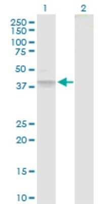 Western Blot: beta-1,3-Glucuronyltransferase 3/B3GAT3 Antibody [H00026229-D01P]