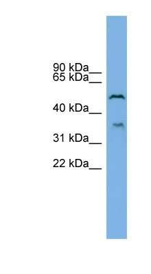 Western Blot: beta-1,3-Glucuronyltransferase 3/B3GAT3 Antibody [NBP1-59853]