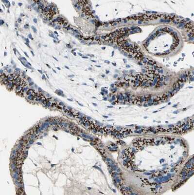Immunohistochemistry-Paraffin: beta-1,4-Galactosyltransferase 1/B4GalT1 Antibody [NBP1-88654]