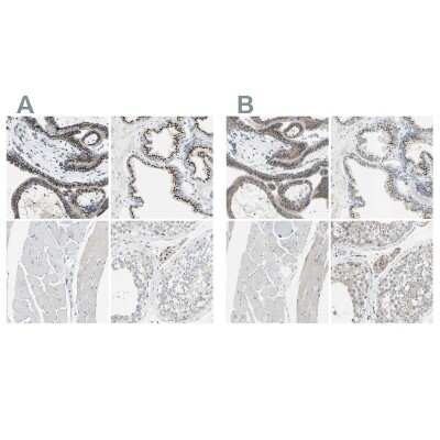 Immunohistochemistry-Paraffin: beta-1,4-Galactosyltransferase 1/B4GalT1 Antibody [NBP1-88654]