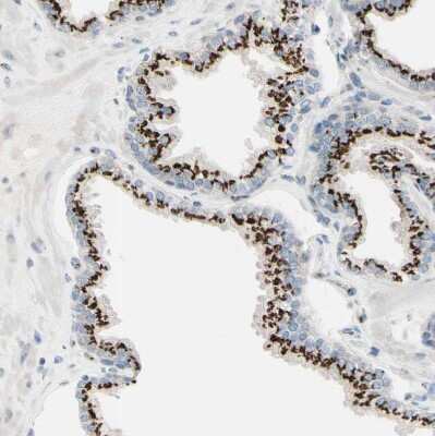 Immunohistochemistry-Paraffin: beta-1,4-Galactosyltransferase 1/B4GalT1 Antibody [NBP1-88654]