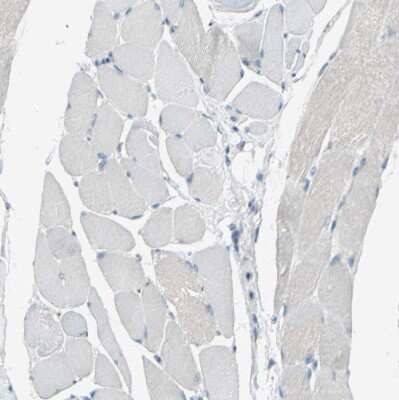 Immunohistochemistry-Paraffin: beta-1,4-Galactosyltransferase 1/B4GalT1 Antibody [NBP1-88654]