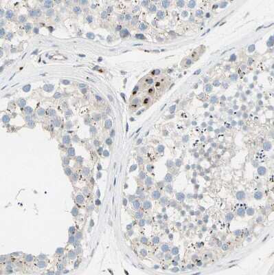 Immunohistochemistry-Paraffin: beta-1,4-Galactosyltransferase 1/B4GalT1 Antibody [NBP1-88654]