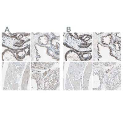 Immunohistochemistry-Paraffin: beta-1,4-Galactosyltransferase 1/B4GalT1 Antibody [NBP1-88655]