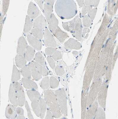 Immunohistochemistry-Paraffin: beta-1,4-Galactosyltransferase 1/B4GalT1 Antibody [NBP1-88655]