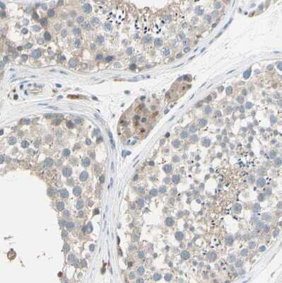 Immunohistochemistry-Paraffin: beta-1,4-Galactosyltransferase 1/B4GalT1 Antibody [NBP1-88655]