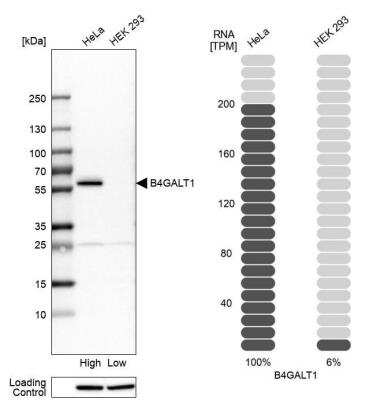 Western Blot: beta-1,4-Galactosyltransferase 1/B4GalT1 Antibody [NBP1-88654]