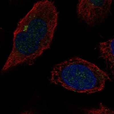 Immunocytochemistry/ Immunofluorescence: beta-1,4-Galactosyltransferase 2/B4GalT2 Antibody [NBP2-58906]