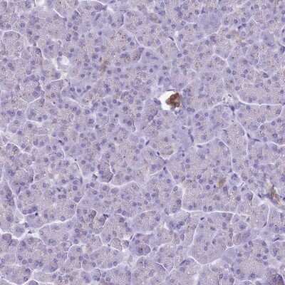 Immunohistochemistry-Paraffin: beta-1,4-Galactosyltransferase 2/B4GalT2 Antibody [NBP2-14342]