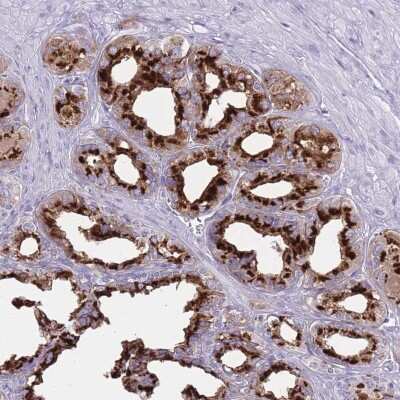 Immunohistochemistry-Paraffin: beta-1,4-Galactosyltransferase 2/B4GalT2 Antibody [NBP2-14342]
