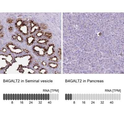 Immunohistochemistry-Paraffin: beta-1,4-Galactosyltransferase 2/B4GalT2 Antibody [NBP2-14342]