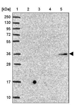 Western Blot: beta-1,4-Galactosyltransferase 2/B4GalT2 Antibody [NBP2-14342]