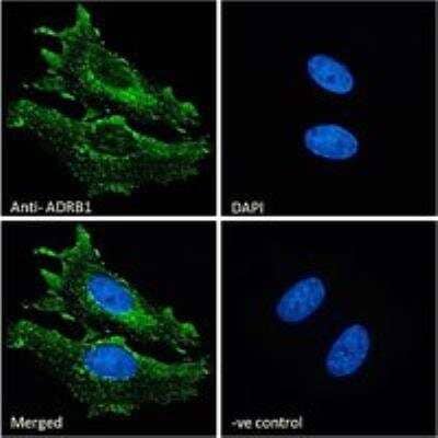 Immunocytochemistry/ Immunofluorescence: beta-1 Adrenergic R/ADRB1 Antibody [NB600-978]