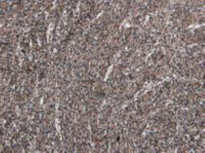 Immunohistochemistry-Paraffin: beta-1 Adrenergic R/ADRB1 Antibody [NB600-978]