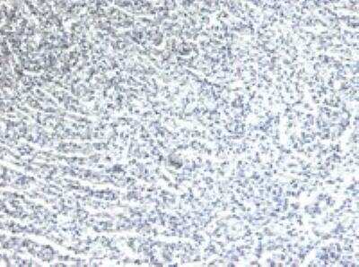 Immunohistochemistry-Paraffin: beta-1 Adrenergic R/ADRB1 Antibody [NB600-978]