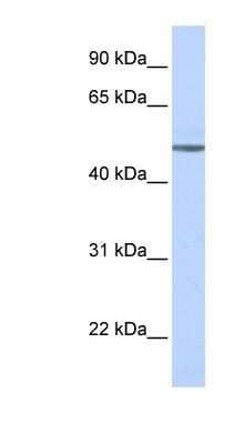 Western Blot: beta-1 Adrenergic R/ADRB1 Antibody [NBP1-59007]