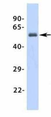 Western Blot: beta-1 Adrenergic R/ADRB1 Antibody [NBP1-59007]