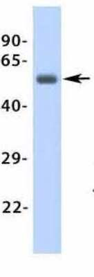 Western Blot: beta-1 Adrenergic R/ADRB1 Antibody [NBP1-59007]