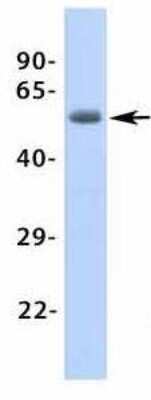 Western Blot: beta-1 Adrenergic R/ADRB1 Antibody [NBP1-59007]