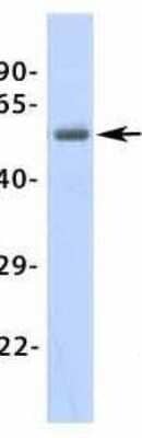 Western Blot: beta-1 Adrenergic R/ADRB1 Antibody [NBP1-59007]