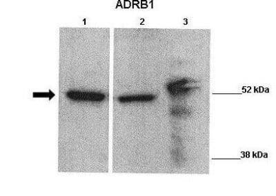 Western Blot: beta-1 Adrenergic R/ADRB1 Antibody [NBP1-59007]