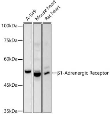 Western Blot: beta-1 Adrenergic R/ADRB1 AntibodyAzide and BSA Free [NBP3-16089]