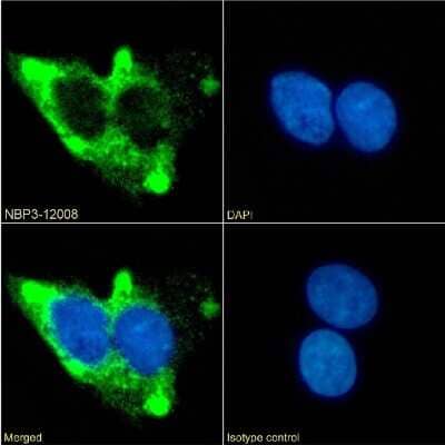 Immunocytochemistry/ Immunofluorescence: beta-2 Adrenergic R/ADRB2 Antibody (13D6) - Chimeric - Azide and BSA Free [NBP3-12008]