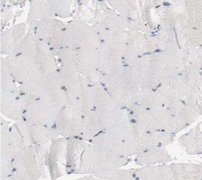 Immunohistochemistry-Paraffin: beta-2 Adrenergic R/ADRB2 Antibody [NBP1-90227]