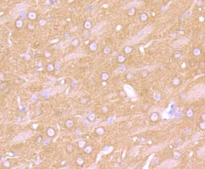 Immunohistochemistry-Paraffin: beta-2 Adrenergic R/ADRB2 Antibody (JM102-06) [NBP2-67187]