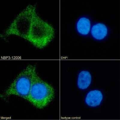 Immunocytochemistry/ Immunofluorescence: beta-2 Adrenergic R/ADRB2 Antibody (R11/E1) - Chimeric - Azide and BSA Free [NBP3-12006]