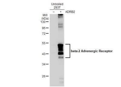 Western Blot: beta-2 Adrenergic R/ADRB2 Antibody [NBP2-15564]