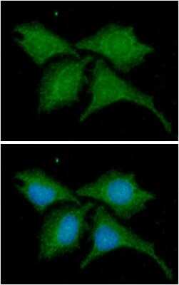 Immunocytochemistry/ Immunofluorescence: beta 2-Microglobulin Antibody (101F10) - BSA Free [NBP2-59477]