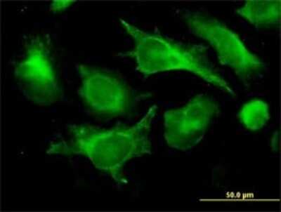 Immunocytochemistry/ Immunofluorescence: beta 2-Microglobulin Antibody (3F9-2C2) [H00000567-M01]