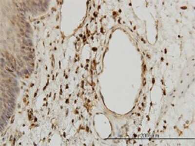 Immunohistochemistry-Paraffin: beta 2-Microglobulin Antibody (3F9-2C2) [H00000567-M01]