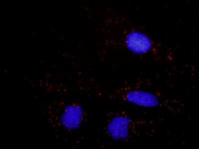 Proximity Ligation Assay: beta 2-Microglobulin Antibody (3F9-2C2) [H00000567-M01]