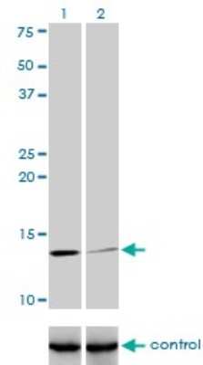 Western Blot: beta 2-Microglobulin Antibody (3F9-2C2) [H00000567-M01]