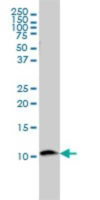 Western Blot: beta 2-Microglobulin Antibody (3F9-2C2) [H00000567-M01]