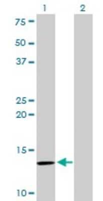 Western Blot: beta 2-Microglobulin Antibody (3F9-2C2) [H00000567-M01]