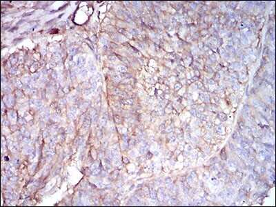 Immunohistochemistry: beta 2-Microglobulin Antibody (3G5H8) - BSA Free [NBP2-37287]