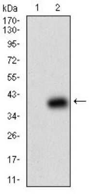 Western Blot: beta 2-Microglobulin Antibody (3G5H8)BSA Free [NBP2-37287]