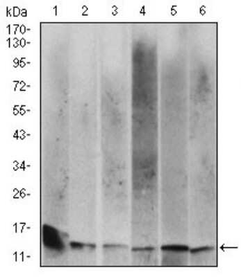 Western Blot: beta 2-Microglobulin Antibody (3G5H8)BSA Free [NBP2-37287]