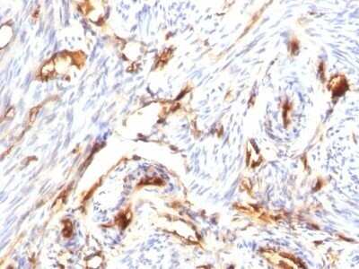Immunohistochemistry-Paraffin: beta 2-Microglobulin Antibody (B2M/1118) - Azide and BSA Free [NBP2-47702]