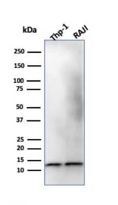 Western Blot: beta 2-Microglobulin Antibody (B2M/1118)Azide and BSA Free [NBP2-47702]