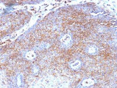 Immunohistochemistry-Paraffin: beta 2-Microglobulin Antibody (B2M/1118) - IHC-Prediluted [NBP2-48327]